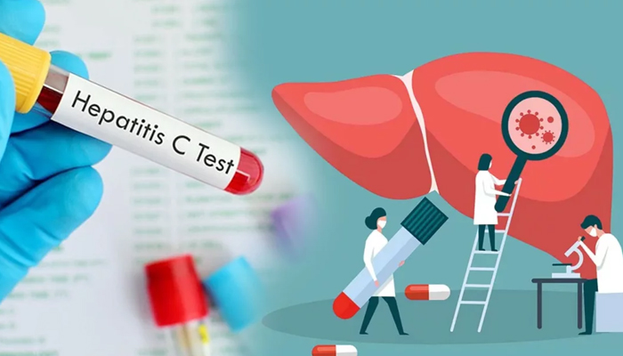 বিশ্বে হেপাটাইটিস সি রোগীর সংখ্যায় সবার উপরে পাকিস্তান বিশ্বে হেপাটাইটিস সি রোগীর সংখ্যায় সবার উপরে পাকিস্তান