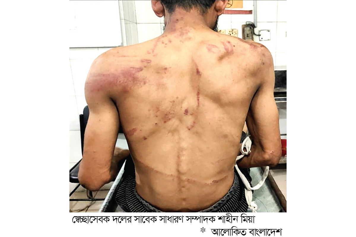 স্বেচ্ছাসেবক দলনেতাকে অপহরণ করে নির্যাতনের অভিযোগ