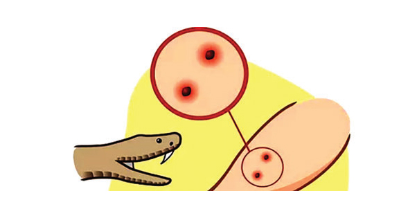 শৈলকূপায় সাপেকাটা রোগীদের জন্য এন্টিভেনম হস্তান্তর শৈলকূপায় সাপেকাটা রোগীদের জন্য এন্টিভেনম হস্তান্তর