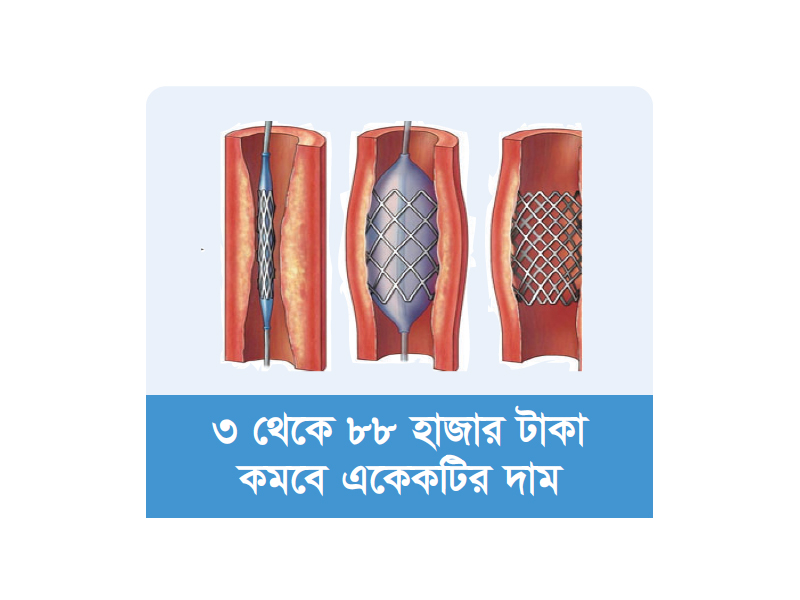 হার্টের রিংয়ের দাম কমানোর সিদ্ধান্ত সরকারের হার্টের রিংয়ের দাম কমানোর সিদ্ধান্ত সরকারের