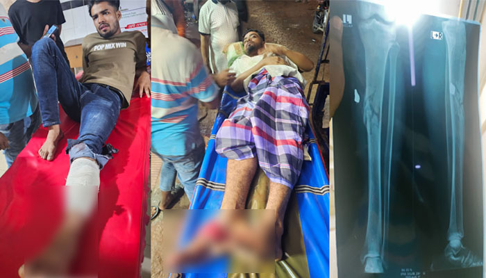 বেগমগঞ্জে ফুটবল দ্বন্দ্ব, যুবদল কর্মীর গুলিতে জামায়াতের ২ কর্মী আহত বেগমগঞ্জে ফুটবল দ্বন্দ্ব, যুবদল কর্মীর গুলিতে জামায়াতের ২ কর্মী আহত