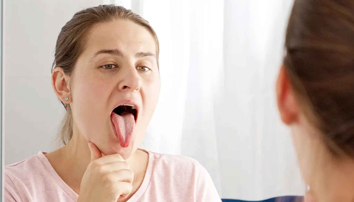 জিভে সাদা আস্তরণ: কোন রোগের লক্ষণ হতে পারে? জিভে সাদা আস্তরণ: কোন রোগের লক্ষণ হতে পারে?