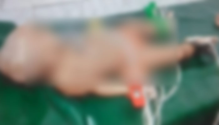 শেরপুরে গলায় পেয়ারা আটকে কন্যাশিশুর মৃত্যু শেরপুরে গলায় পেয়ারা আটকে কন্যাশিশুর মৃত্যু