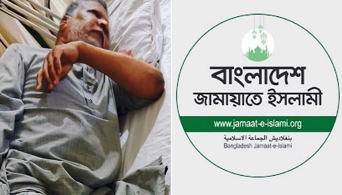 জাগপা সভাপতির ওপর হামলার নিন্দা জামায়াতের জাগপা সভাপতির ওপর হামলার নিন্দা জামায়াতের