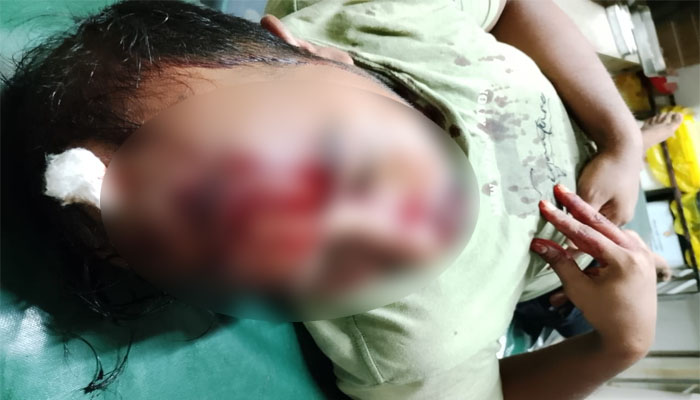 প্রতিপক্ষকে ফাঁসাতে আপন ভাইয়ের মাথা ফাটালেন বড় ভাই প্রতিপক্ষকে ফাঁসাতে আপন ভাইয়ের মাথা ফাটালেন বড় ভাই