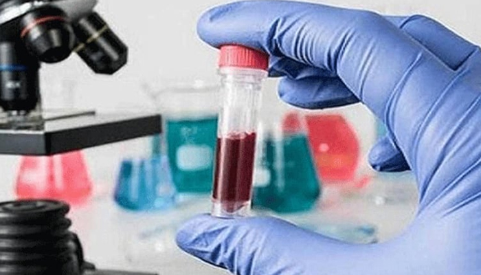 কারাগারে শুরু হলো ডোপ টেস্ট কার্যক্রম কারাগারে শুরু হলো ডোপ টেস্ট কার্যক্রম