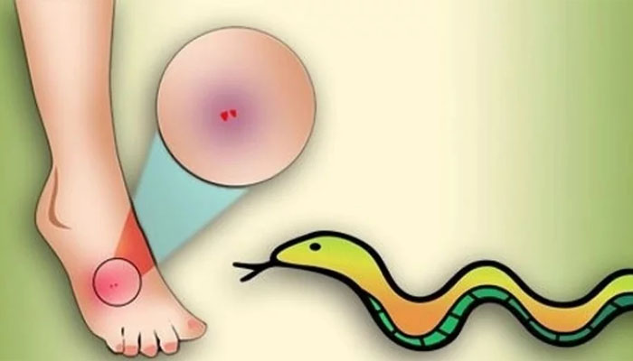 এন্টিভেনম দেওয়ার পরেও মারা গেলেন সাপে কাটা রোগী এন্টিভেনম দেওয়ার পরেও মারা গেলেন সাপে কাটা রোগী