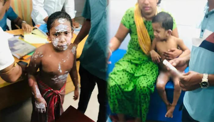 নোয়াখালীতে গ্যাস লিকেজ থেকে বিস্ফোরণ, একই পরিবারে দগ্ধ ৪