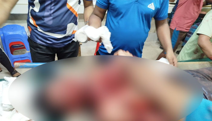 নোয়াখালীতে কিশোরকে কুপিয়ে হত্যা, মারধরে আরেকজনের মৃত্যু নোয়াখালীতে কিশোরকে কুপিয়ে হত্যা, মারধরে আরেকজনের মৃত্যু