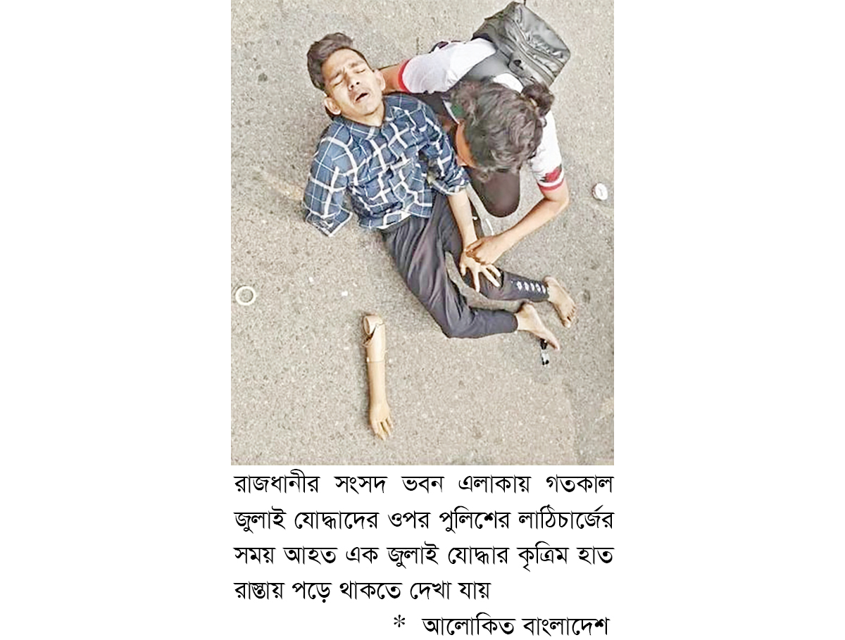 রাস্তায় পড়ে ছিল জুলাই যোদ্ধার কৃত্রিম হাত রাস্তায় পড়ে ছিল জুলাই যোদ্ধার কৃত্রিম হাত