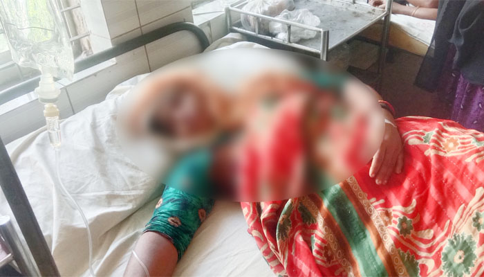 চাচিকে মারধর করে মাথায় জখম করার অভিযোগ