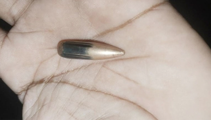 মিয়ানমার থেকে ছোড়া গুলিতে বিদ্ধ বাংলাদেশের নারী মিয়ানমার থেকে ছোড়া গুলিতে বিদ্ধ বাংলাদেশের নারী