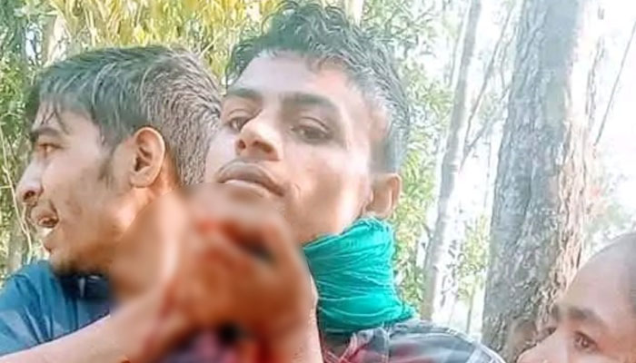 স্বামী-স্ত্রীর কলহে নিজ হাতে লিঙ্গ কর্তন ও গলায় ছুরিকাঘাত