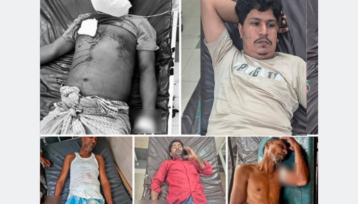 চট্টগ্রামে বিএনপির আরও ৫ নেতাকর্মী গুলিবিদ্ধ চট্টগ্রামে বিএনপির আরও ৫ নেতাকর্মী গুলিবিদ্ধ