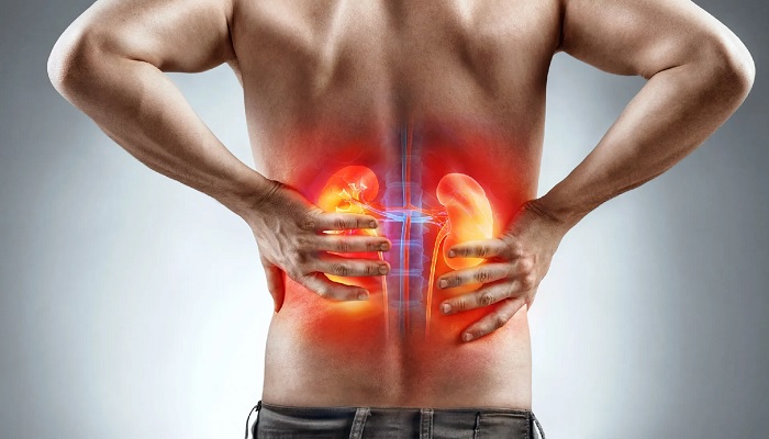 কিডনি সমস্যার লক্ষণ কিডনি সমস্যার লক্ষণ