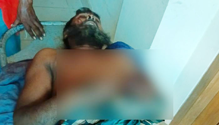 সাটুরিয়ায় জমি নিয়ে সংঘর্ষ: নারীসহ গুরুতর আহত ৩ সাটুরিয়ায় জমি নিয়ে সংঘর্ষ: নারীসহ গুরুতর আহত ৩