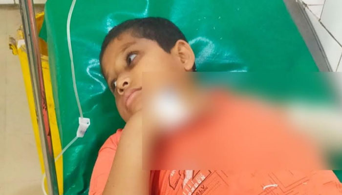 হাজীগঞ্জে ২ গাড়ির চাপায় শিশুর হাত বিচ্ছিন্ন হাজীগঞ্জে ২ গাড়ির চাপায় শিশুর হাত বিচ্ছিন্ন