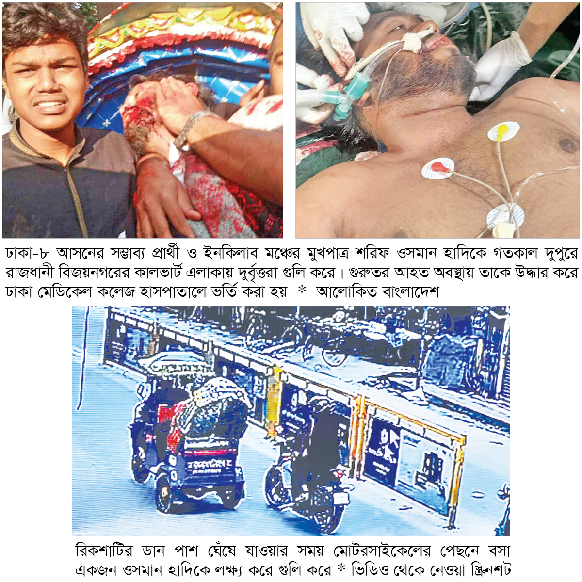 গুলিবিদ্ধ হাদি লাইফ সাপোর্টে গুলিবিদ্ধ হাদি লাইফ সাপোর্টে