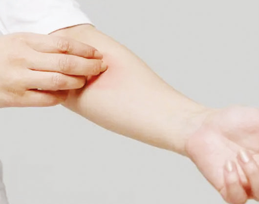 কুষ্ঠ রোগ সম্পর্কে ভুল ধারণা কুষ্ঠ রোগ সম্পর্কে ভুল ধারণা