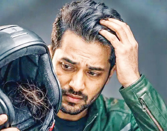 হেলমেট পরলে কি চুল পড়ে হেলমেট পরলে কি চুল পড়ে