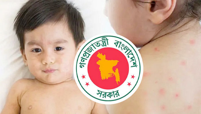 ২৪ ঘণ্টায় হাম ও উপসর্গে আরও ৪ শিশুর মৃত্যু ২৪ ঘণ্টায় হাম ও উপসর্গে আরও ৪ শিশুর মৃত্যু