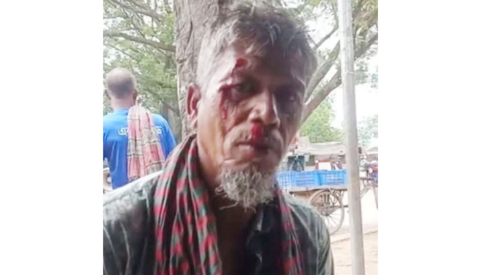 দামুড়হুদায় ডিবি পরিচয়ে ব্যবসায়ীকে কুপিয়ে টাকা ছিনতাই দামুড়হুদায় ডিবি পরিচয়ে ব্যবসায়ীকে কুপিয়ে টাকা ছিনতাই