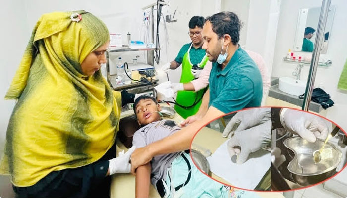 অস্ত্রোপচার ছাড়াই শিশুর পাকস্থলী থেকে ৫ টাকার কয়েন অপসারণ অস্ত্রোপচার ছাড়াই শিশুর পাকস্থলী থেকে ৫ টাকার কয়েন অপসারণ