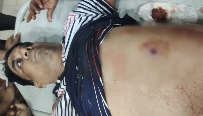 নোয়াখালীতে বিএনপি নেতাকে লক্ষ্য করে গুলি, সহযোগী গুলিবিদ্ধ নোয়াখালীতে বিএনপি নেতাকে লক্ষ্য করে গুলি, সহযোগী গুলিবিদ্ধ