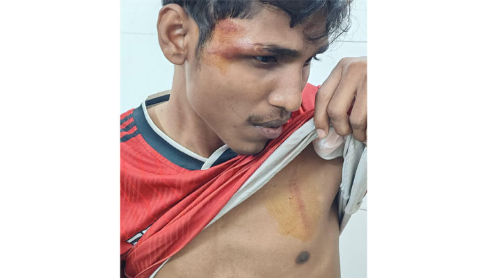 শিক্ষার্থীকে মারধরের অভিযোগ, ঘটনার বর্ণনা দিলেন আসিফ শিক্ষার্থীকে মারধরের অভিযোগ, ঘটনার বর্ণনা দিলেন আসিফ