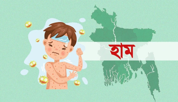 ২৪ ঘণ্টায় হাম ও উপসর্গে ১১ জনের মৃত্যু ২৪ ঘণ্টায় হাম ও উপসর্গে ১১ জনের মৃত্যু
