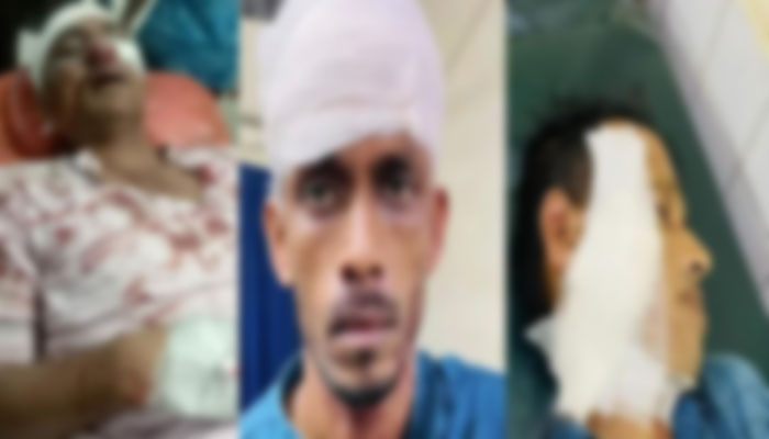 পটিয়ায় মাদক কারবারিদের দুই পক্ষের সংঘর্ষে আহত ৭ পটিয়ায় মাদক কারবারিদের দুই পক্ষের সংঘর্ষে আহত ৭