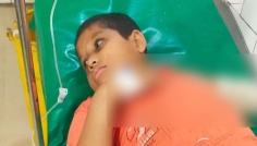 হাজীগঞ্জে ২ গাড়ির চাপায় শিশুর হাত বিচ্ছিন্ন