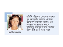 মাথার খুলি খুলে রাখা হয়েছে, ঢাকায় হুজাইফা  