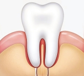 হঠাৎ দাঁতে ব্যথা, কী করবেন  