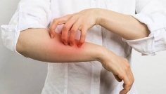 কুষ্ঠ রোগ সম্পর্কে ভুল ধারণা