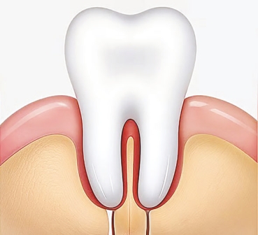 হঠাৎ দাঁতে ব্যথা, কী করবেন  