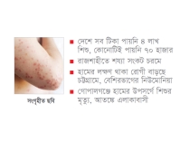 টিকার সংকটে হামের প্রকোপ বাড়ছে  