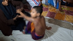 নরসিংদীতে শিক্ষকের প্রহারে শিশুশিক্ষার্থী গুরুতর আহত