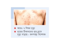 হাম ও উপসর্গে বাড়ছে শিশু মৃত্যু, সর্বোচ্চ শনাক্ত ঢাকায়  