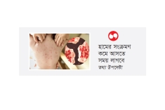 একমাসে হাম ও হামের উপসর্গে ১৯৮ জনের মৃত্যু  
