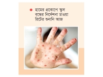 দেশে হাম ও হামের উপসর্গ নিয়ে আরও চার শিশুর মৃত্যু  