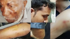 পদ্মায় নৌ পুলিশের ওপর হামলা, ওসিসহ ৫ সদস্য গুলিবিদ্ধ