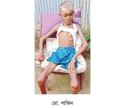 দুর্গাপুরে বিরল রোগে আক্রান্ত ১৬ বছরের কিশোর  