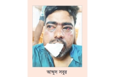 ব্যাংক ‘ভল্টের চাবি’ চেয়ে ম্যানেজারকে নির্যাতন, জড়িতদের গ্রেপ্তার দাবি  