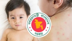 ২৪ ঘণ্টায় হাম ও উপসর্গে আরও ৪ শিশুর মৃত্যু