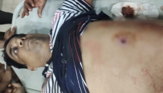 নোয়াখালীতে বিএনপি নেতাকে লক্ষ্য করে গুলি, সহযোগী গুলিবিদ্ধ