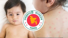 ২৪ ঘণ্টায় হামের উপসর্গে আরও ৭ শিশুর মৃত্যু
