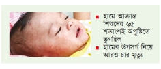 তিন মাসের মধ্যে নিয়ন্ত্রণে আসবে হাম  