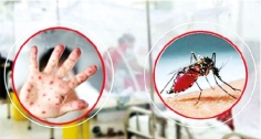 হামের উপসর্গ ও ডেঙ্গুতে প্রাণহানি বাড়ছেই  