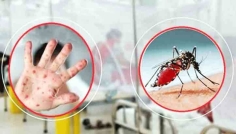 হামের উপসর্গে ১ ও ডেঙ্গুতে প্রাণ গেল আরও ৭ জনের